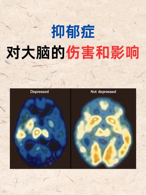 谷维素治好了心脏官能症 谷维素治好了心脏官能症